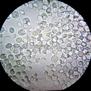 Microscopic image of Baker's Yeast: Saccharomyces cerevisiae